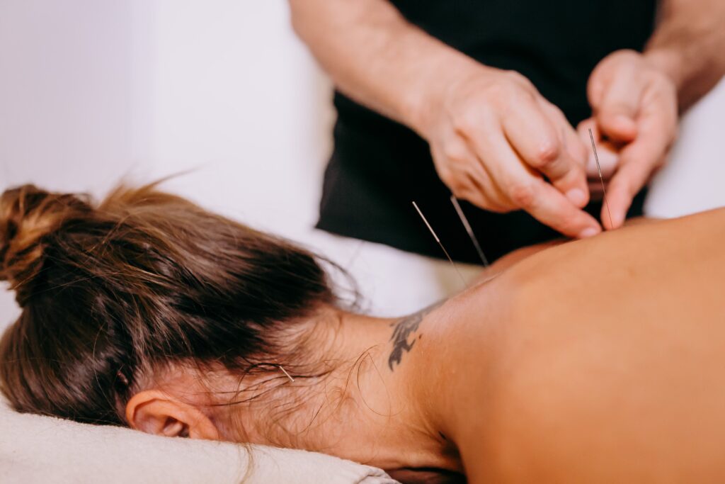 acupuntura para el dolor de espalda y cuello