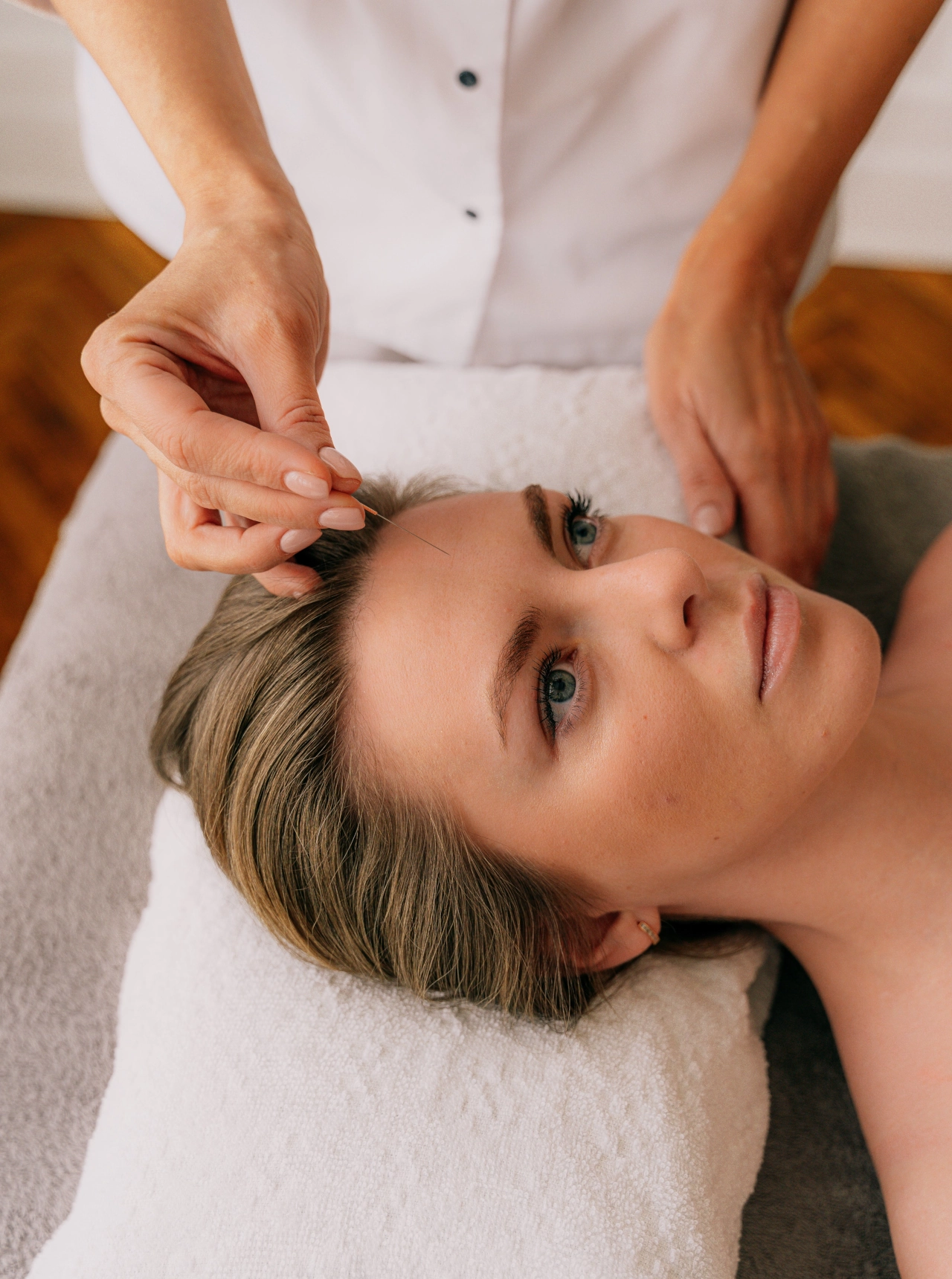 La acupuntura para el dolor de cabeza: eficacia y cómo funciona